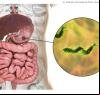 Médico aponta chá anti-inflamatório que ajuda a combater a H. pylori
